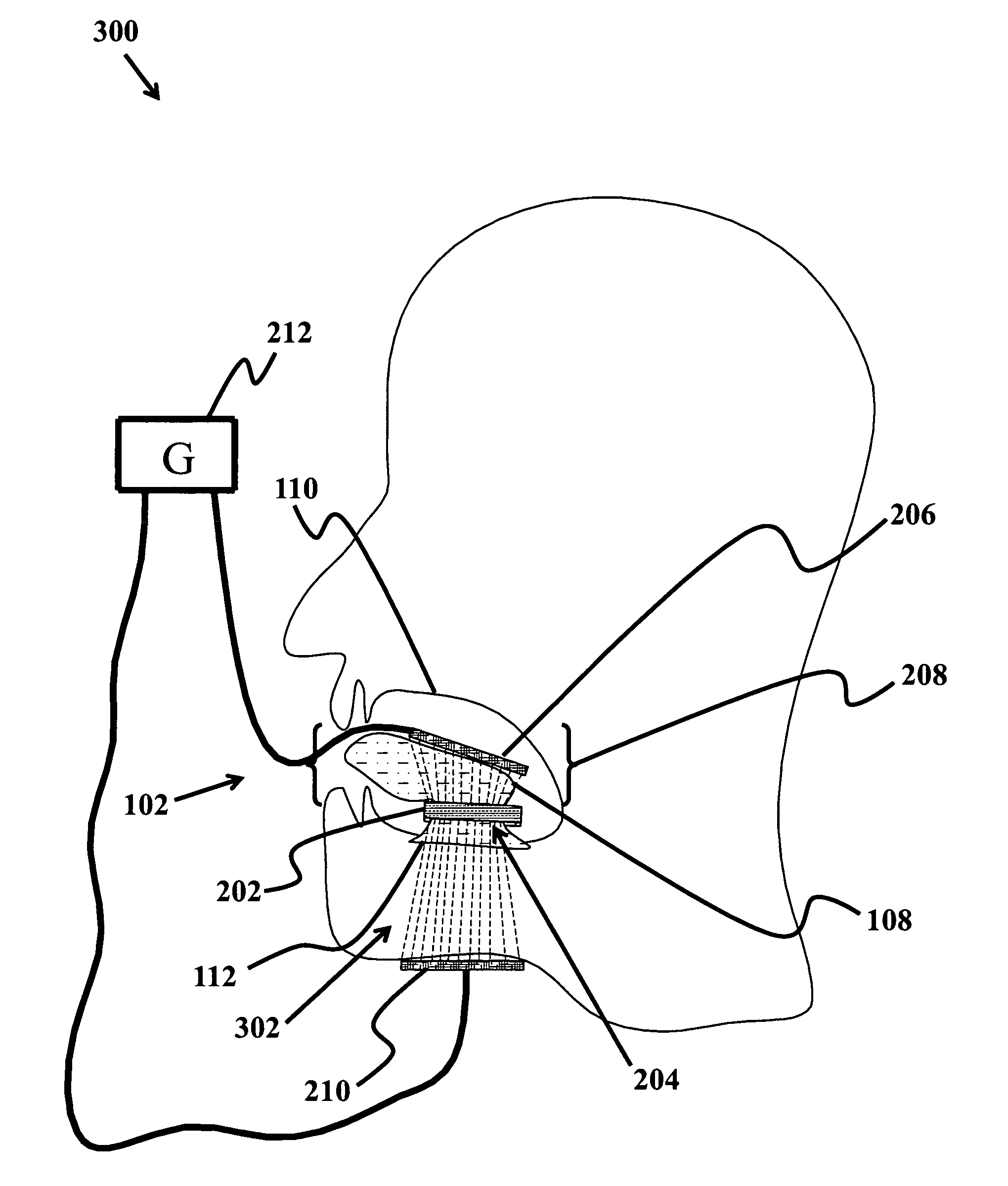 Device and method to treat tissue with electric current