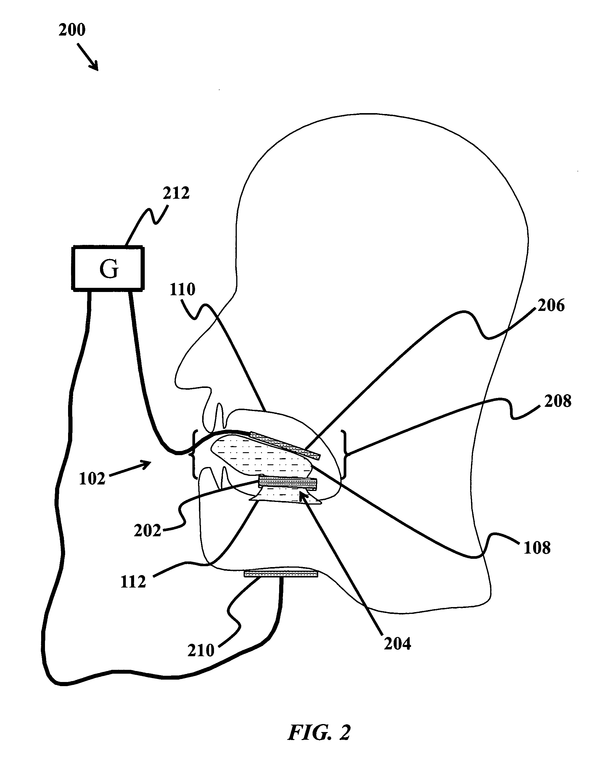 Device and method to treat tissue with electric current