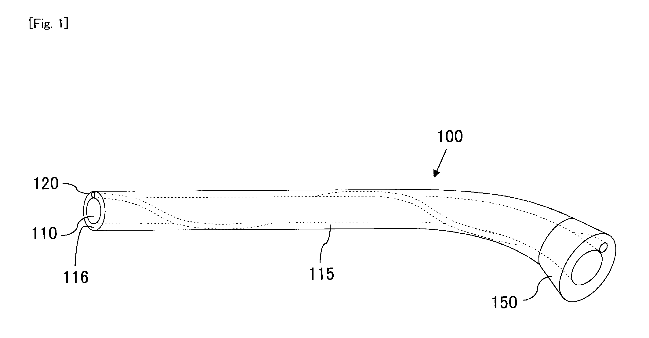 Endoscope overtube