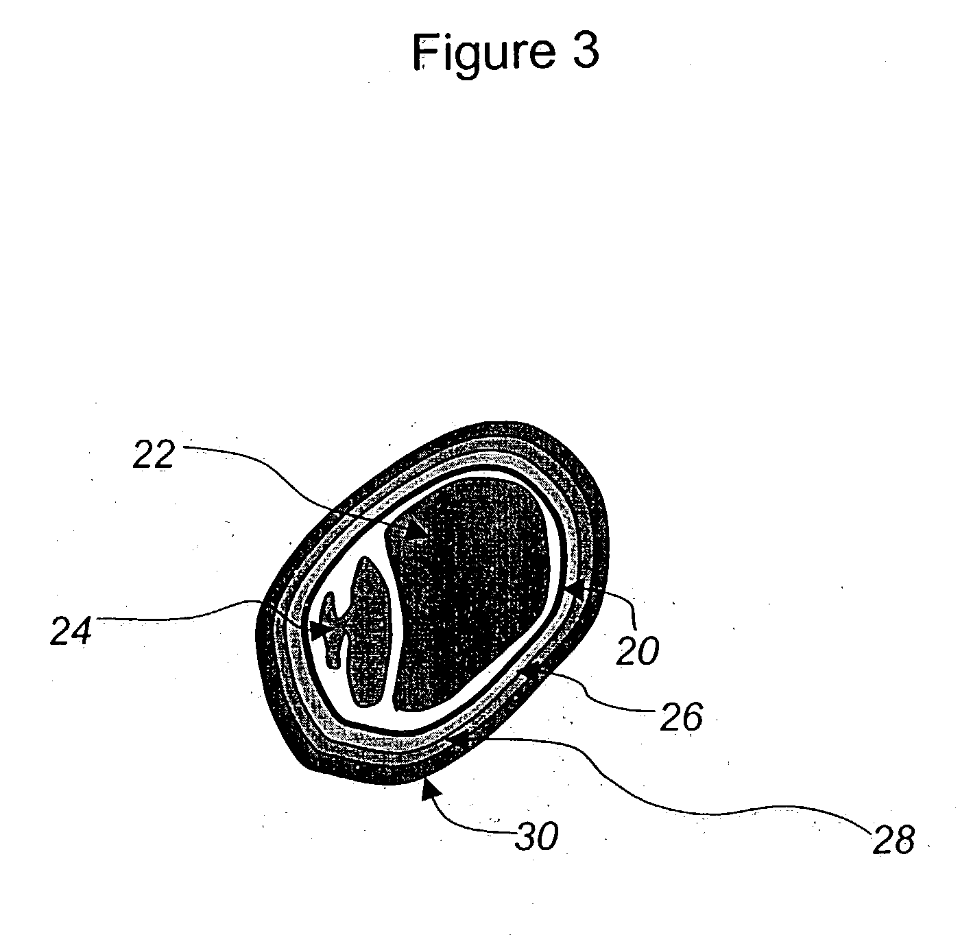 Agricultural seed having protective coatings