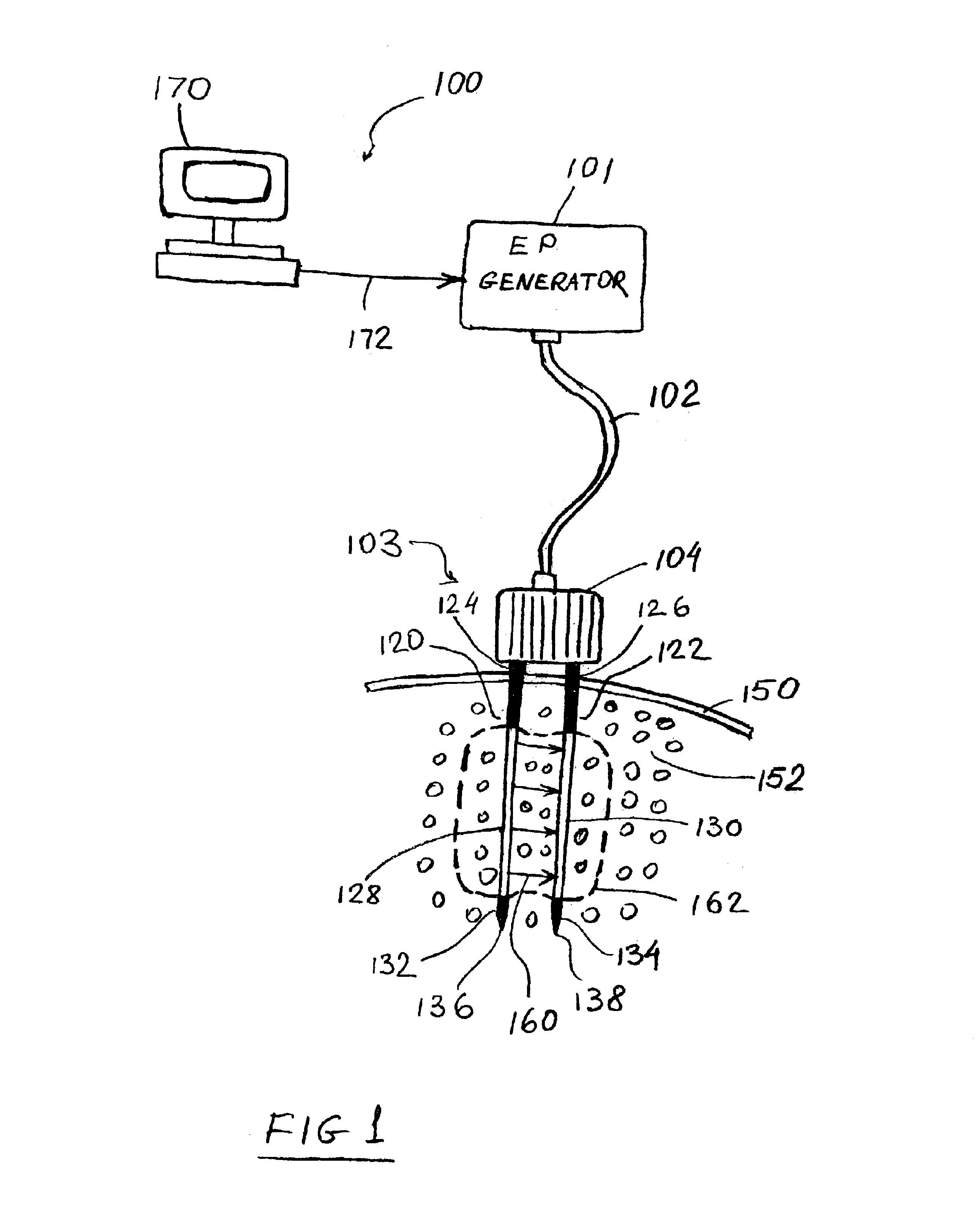 Apparatus and method for reducing subcutaneous fat deposits by electroporation