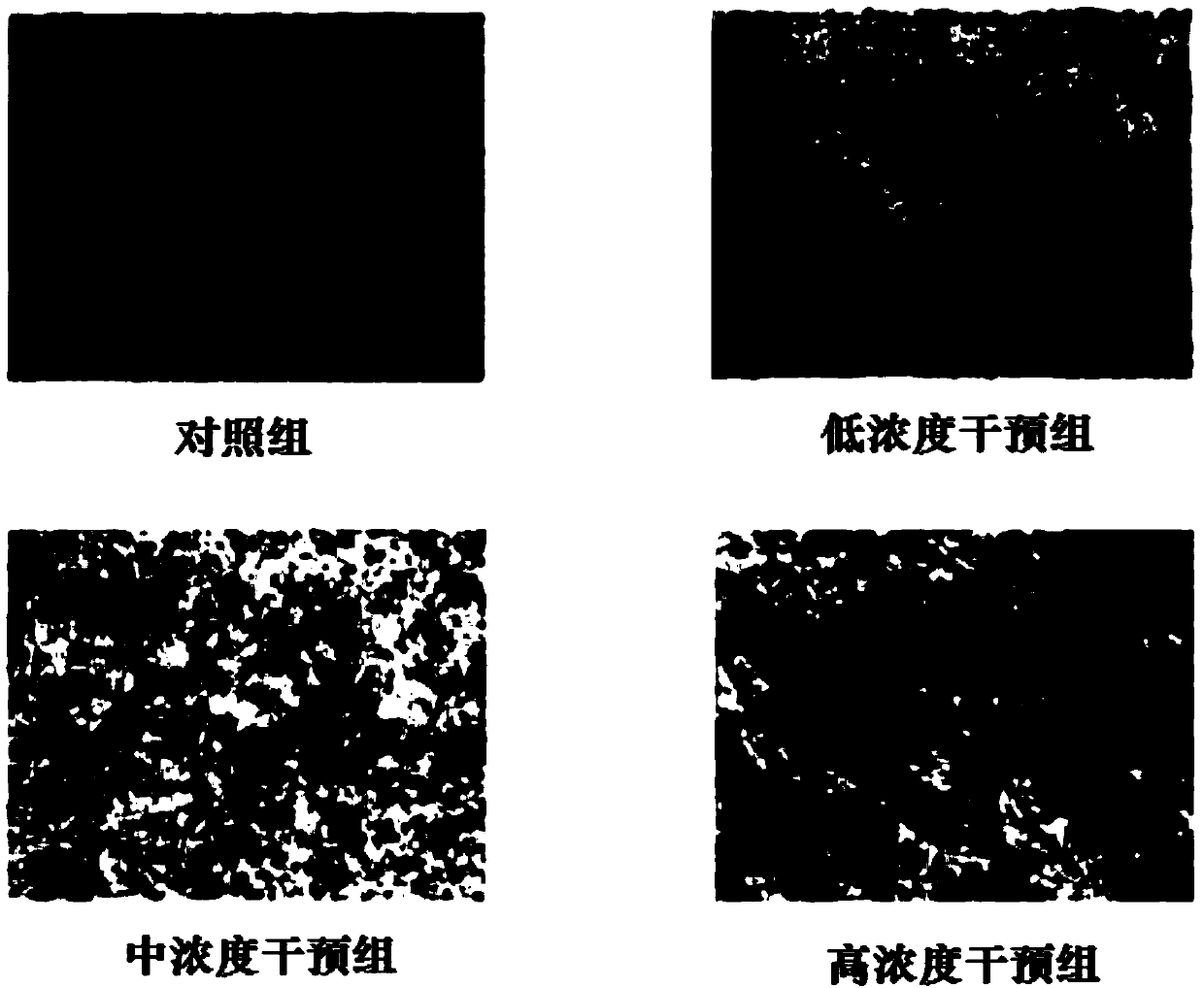 Use of sarpogrelate hydrochloride impurities I for inducing differentiation of bone marrow mesenchymal stem cells