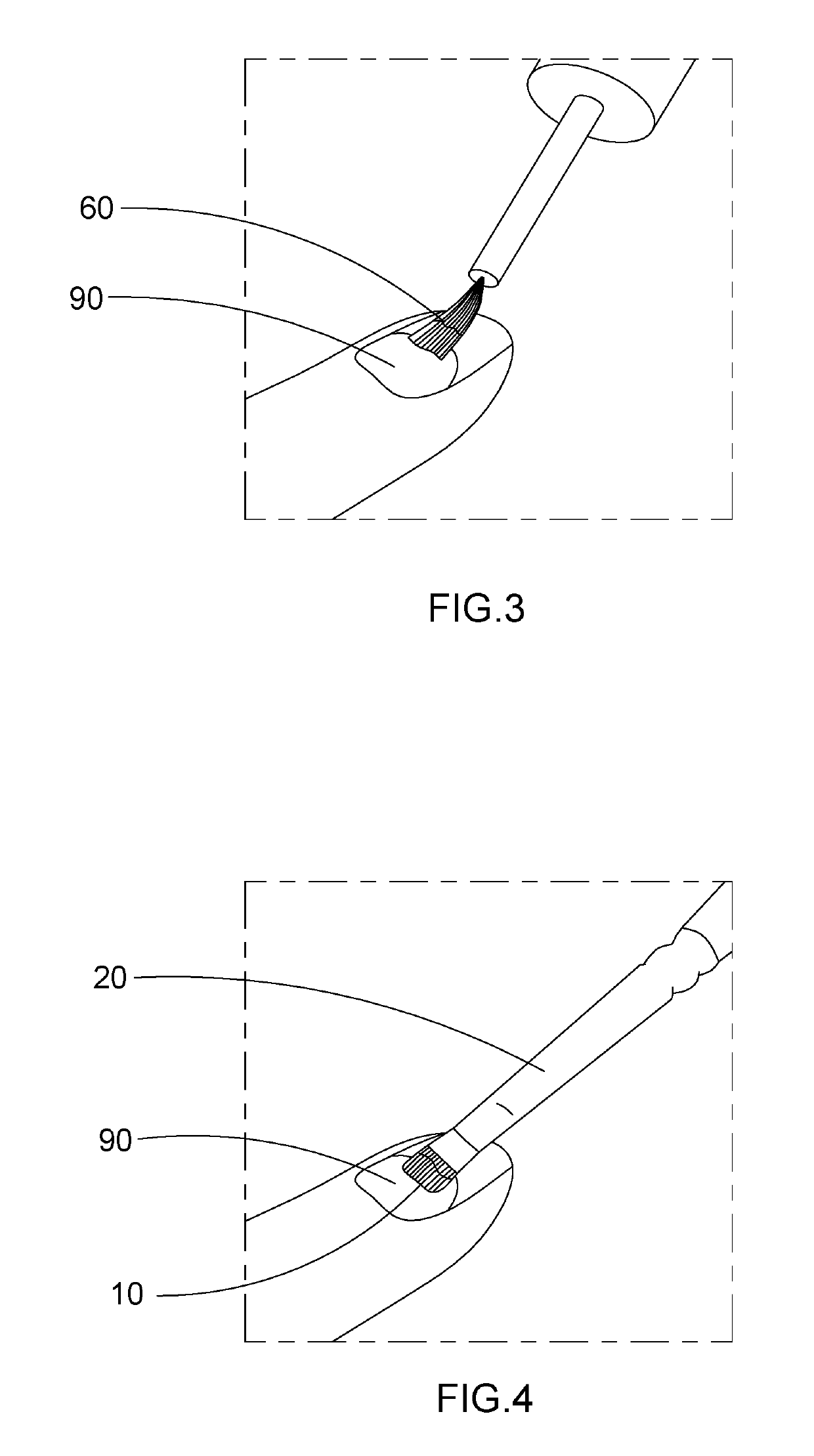 Artificial Nail Tip and Curing Composition Set and Applying Method Thereof