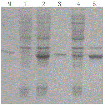 Prokaryotic expression and application of lipase and immobilization method