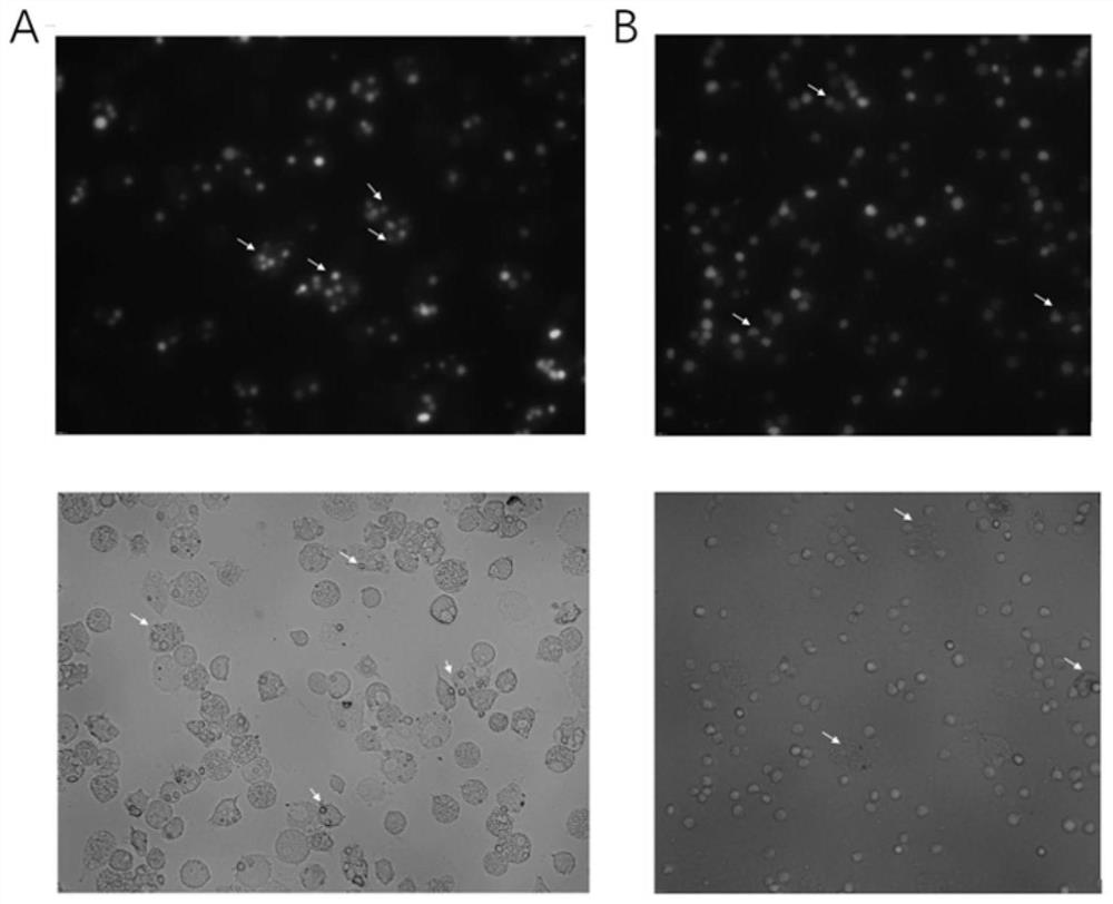 Application of anti-CD47 monoclonal antibody to medicines used for treating acute lymphocytic leukemia cells with amycin resistance