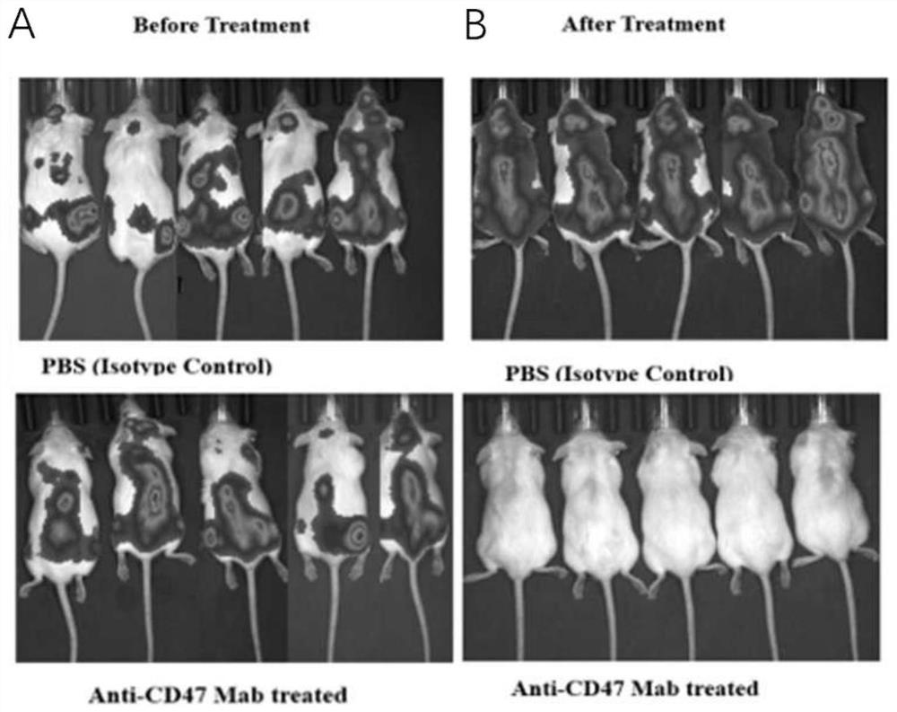 Application of anti-CD47 monoclonal antibody to medicines used for treating acute lymphocytic leukemia cells with amycin resistance