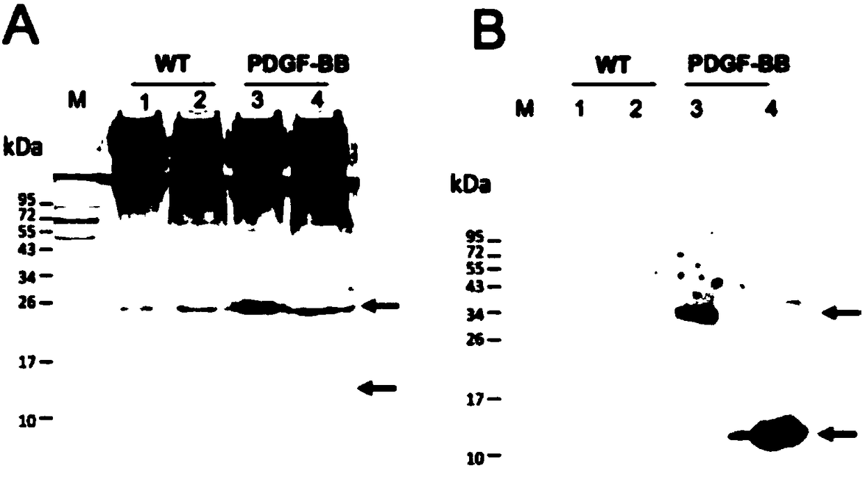 Platelet-derived growth factor modifying gene suitable for silkworm expression and expression vector and application thereof