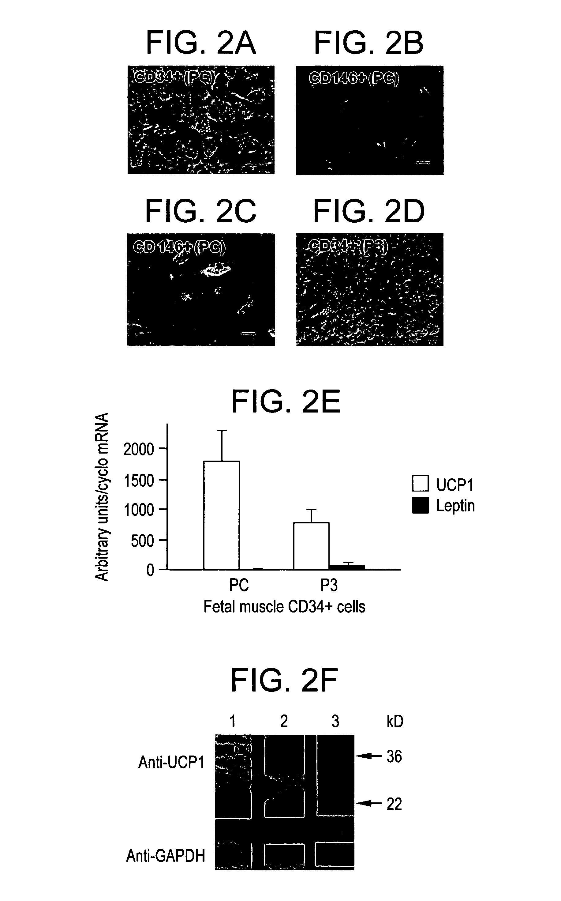 Brown adipocyte progenitors in human skeletal muscle and methods for identifying differentiation agents therefor