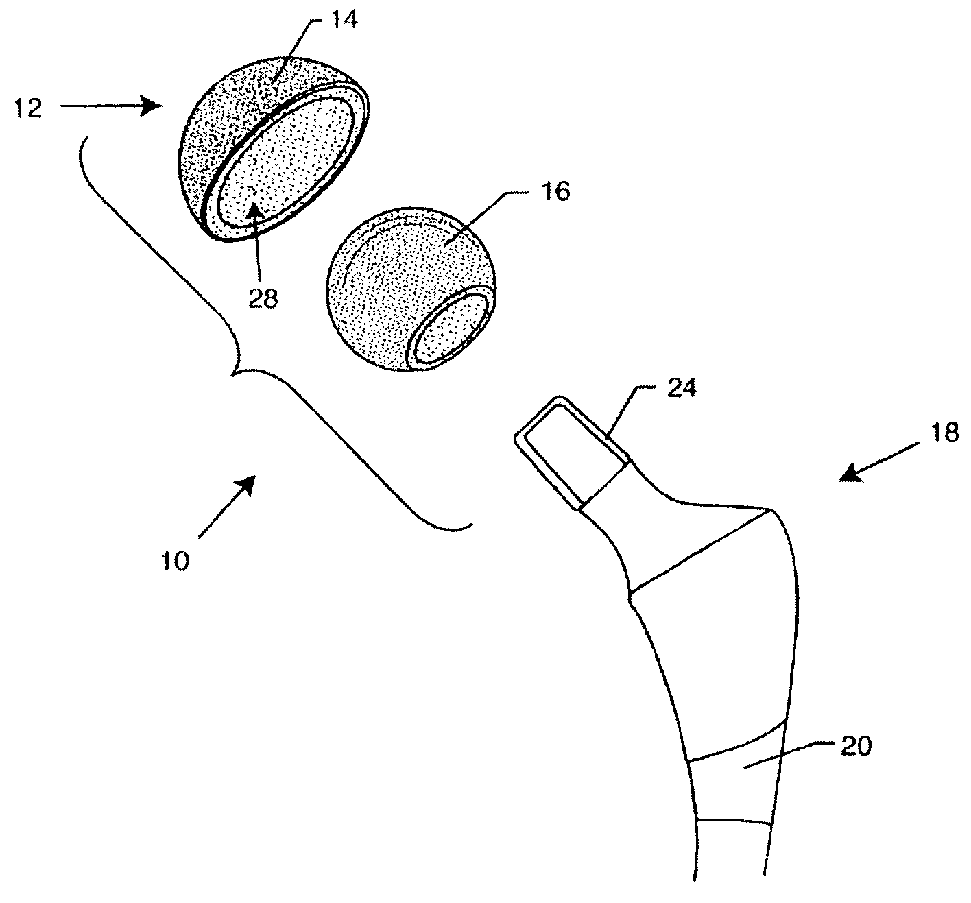 Hip prosthesis with monoblock ceramic acetabular cup