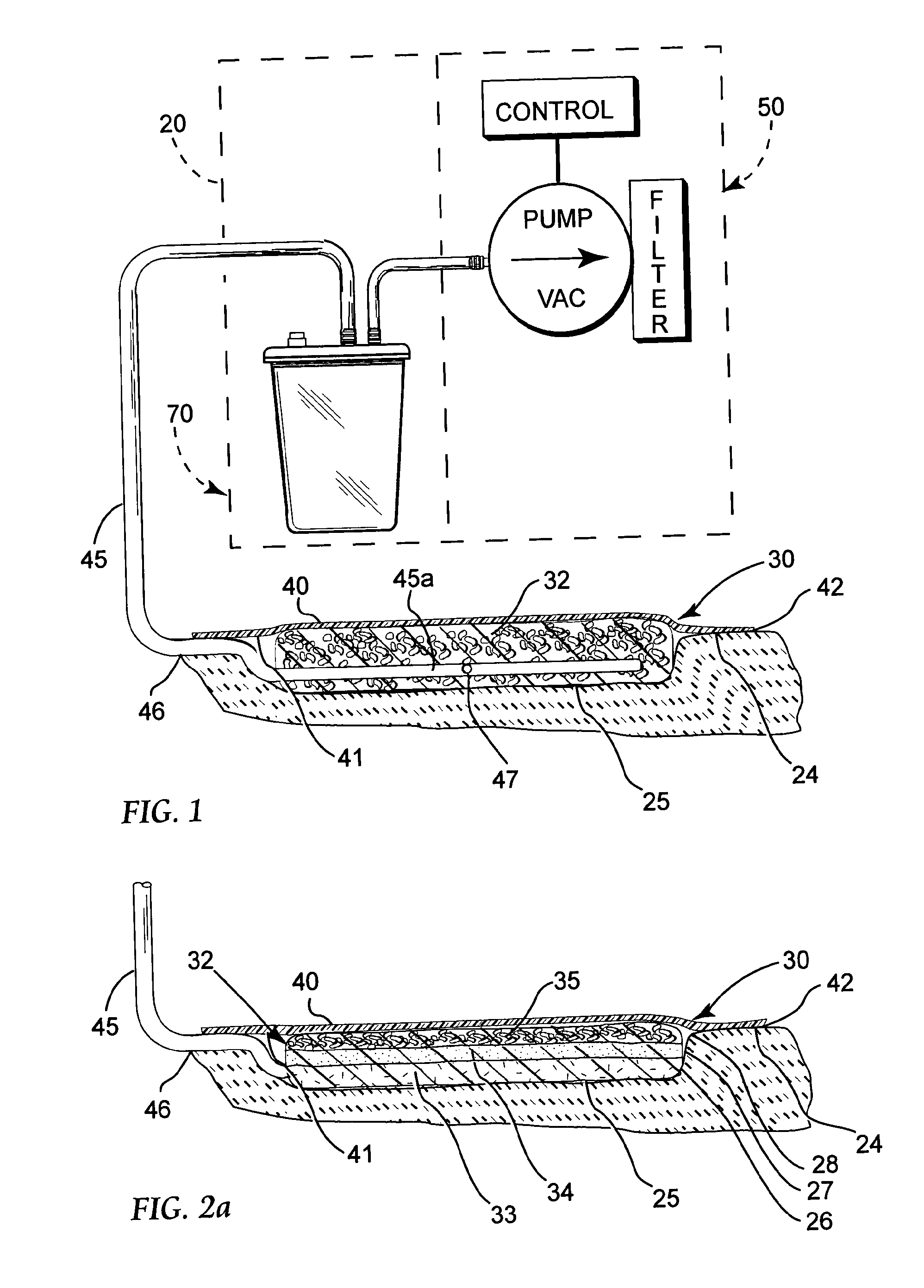 Reduced pressure treatment system