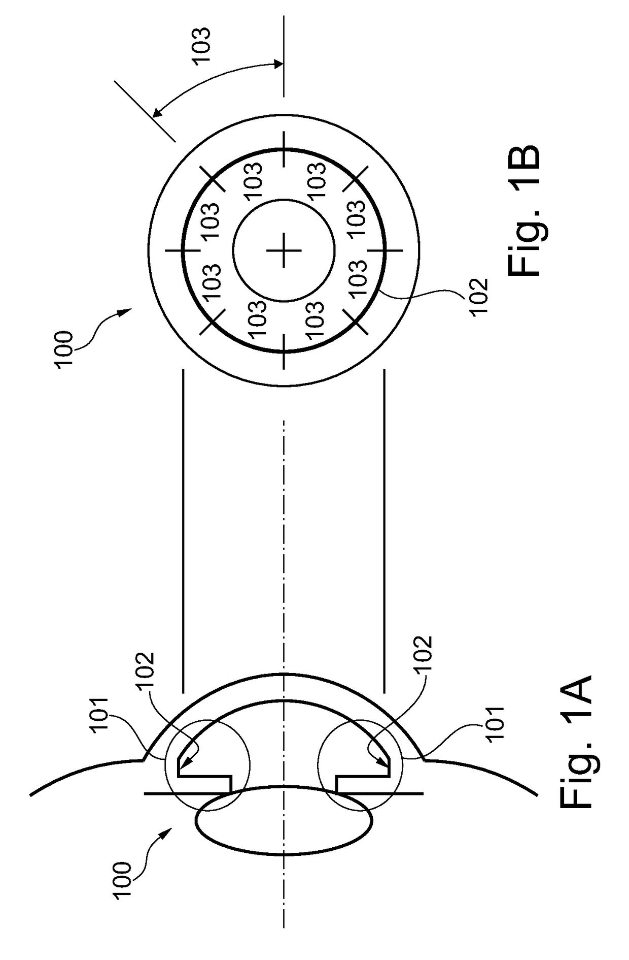 Optical equipment for observation of the iridocorneal zone, methods of measuring and/or evaluating the iridocorneal zone