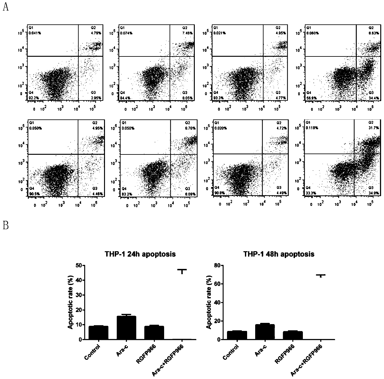 Combined drug for treating leukemia and its application in treating leukemia