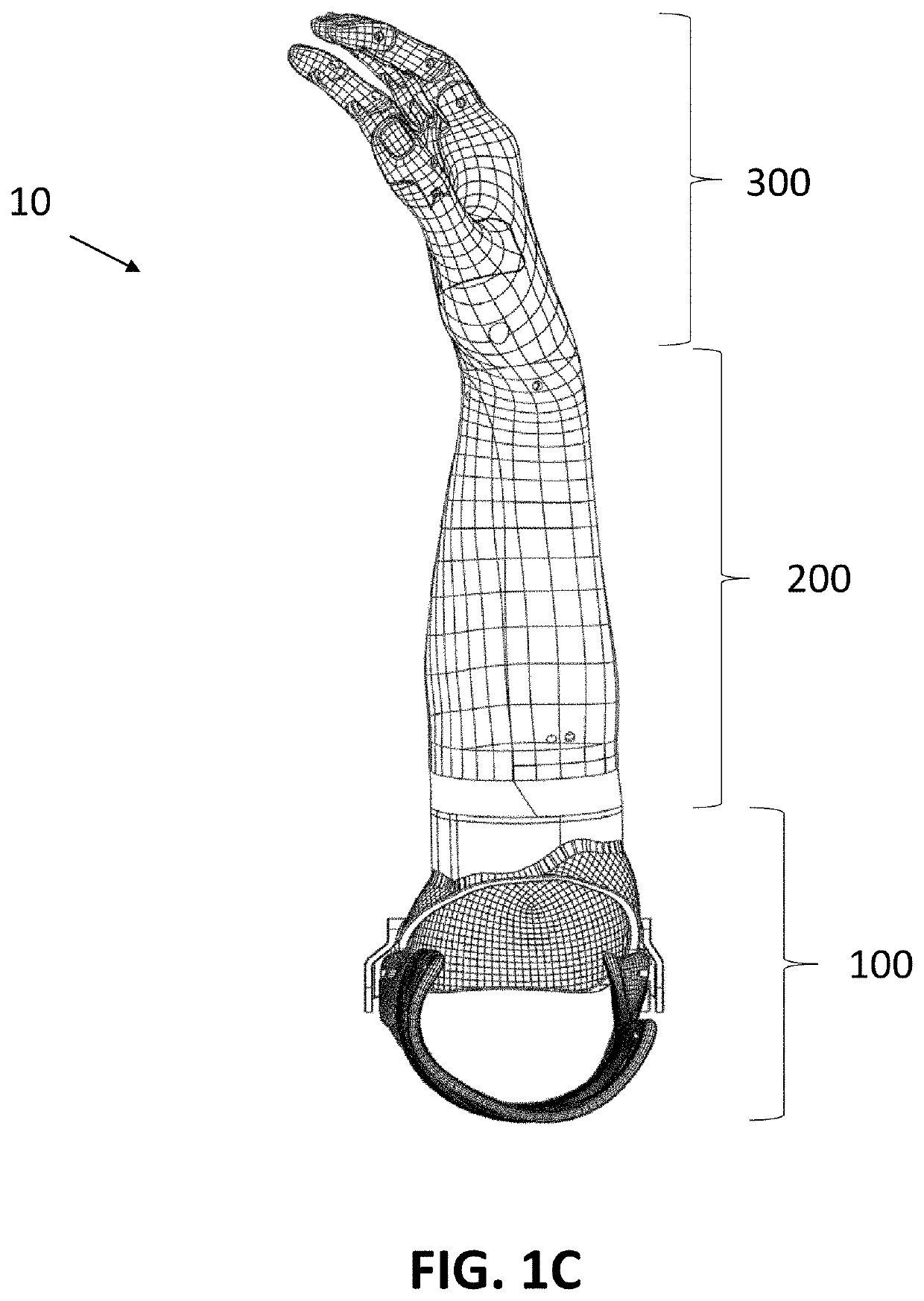 Socket for Upper Extremity Prosthesis