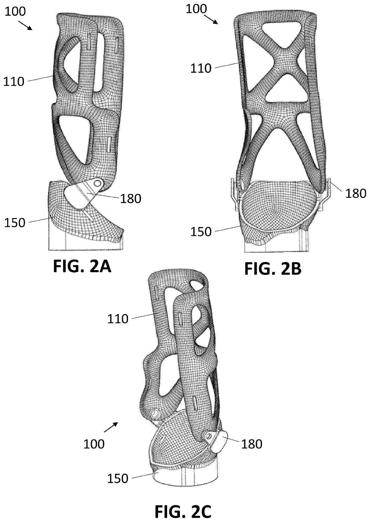 Socket for Upper Extremity Prosthesis