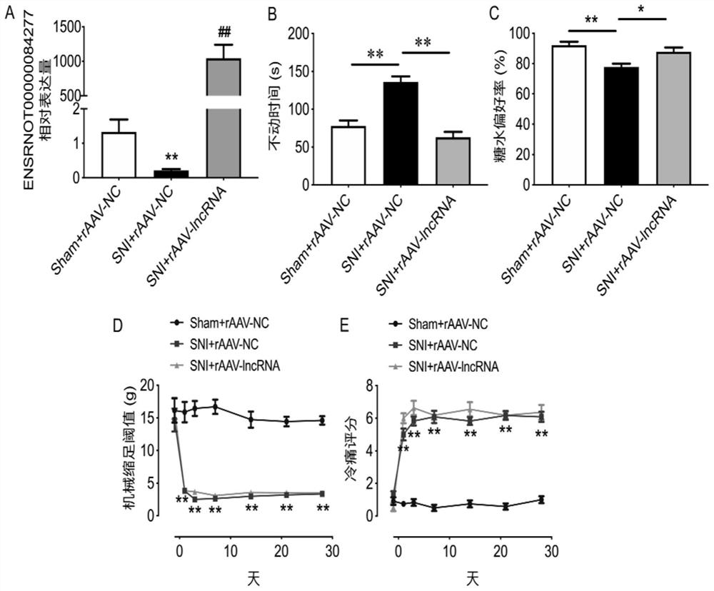 Application of ENSRNOT00000084277 in preparation of medicine for preventing and treating chronic pain related depressive emotion