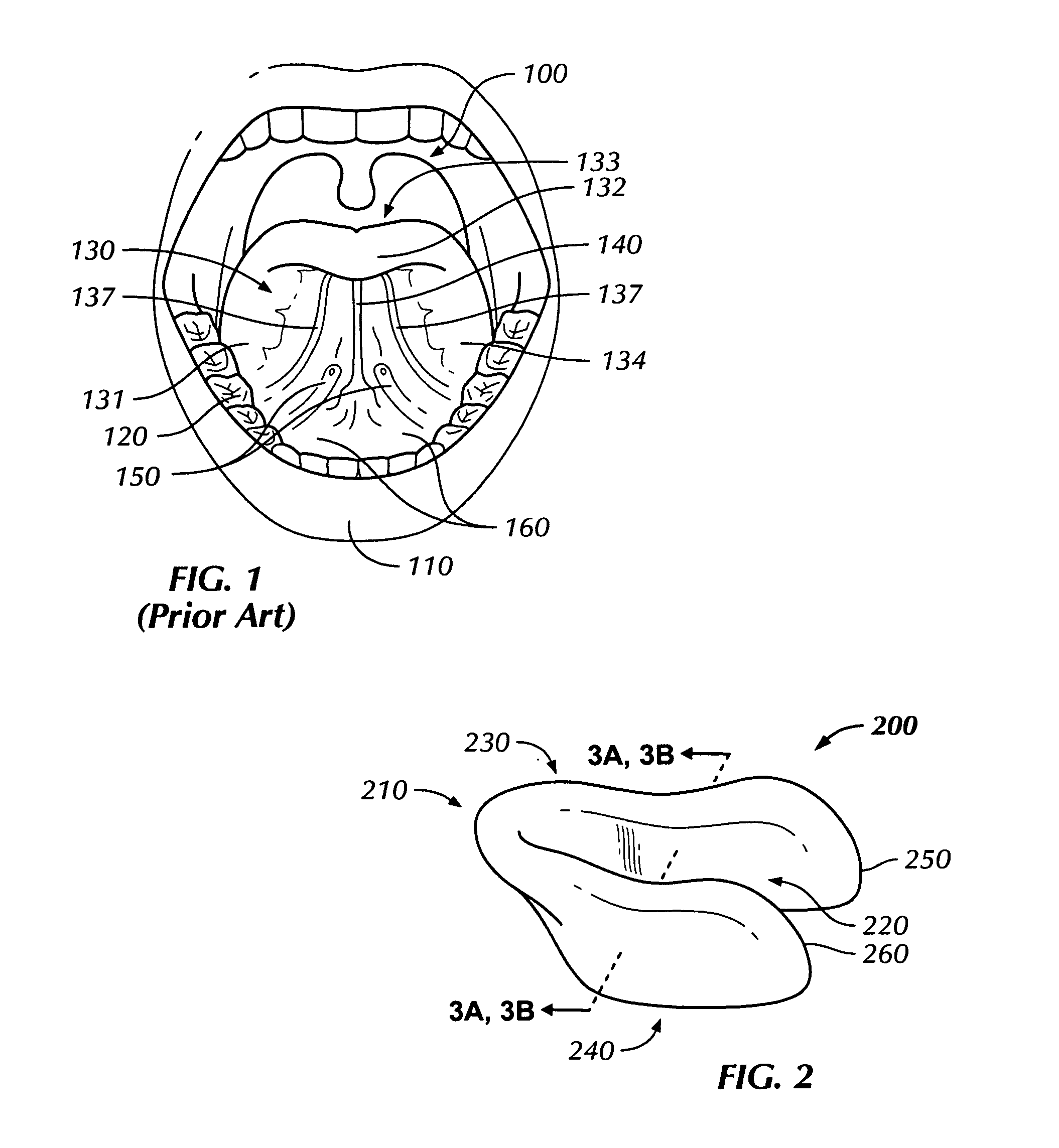 Lingual Vestibular Dosage-form and Delivery System for Transmucosal Administration of Pharmaceutical Agents