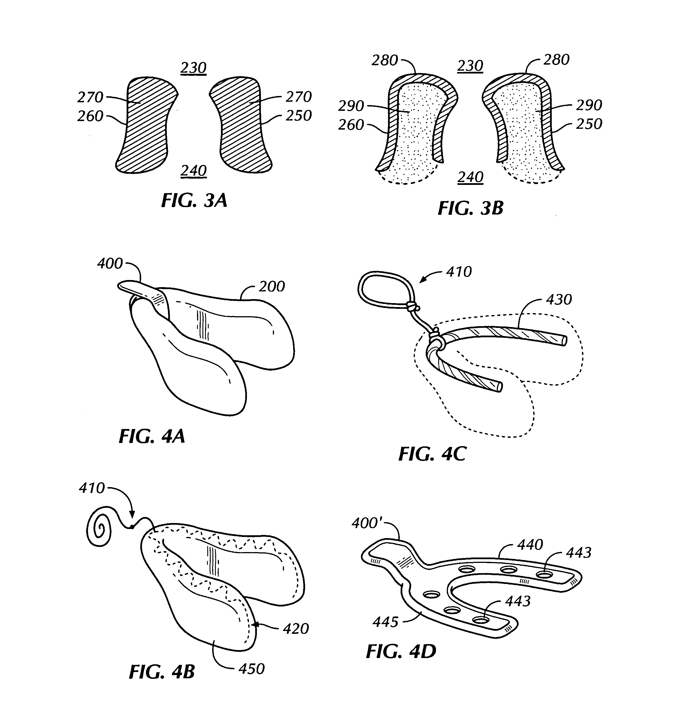 Lingual Vestibular Dosage-form and Delivery System for Transmucosal Administration of Pharmaceutical Agents