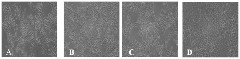 Porcine parvovirus infectious cloning system stably carrying genetic markers and its construction method and application