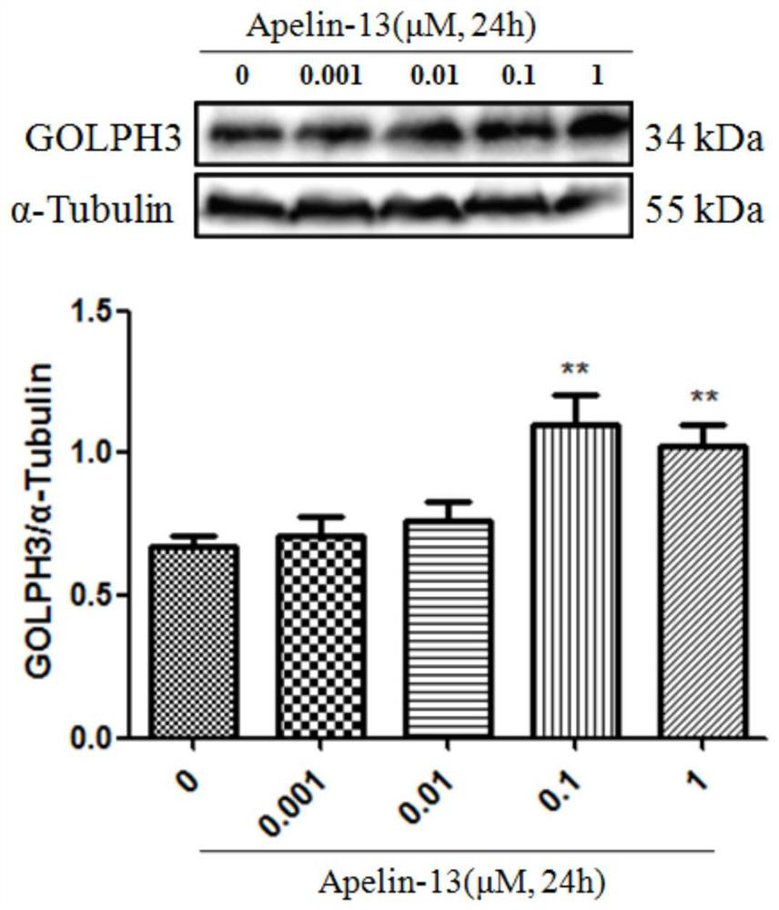Application of siRNA-golph3 in the preparation of drugs for preventing or treating cardiomyocyte hypertrophy