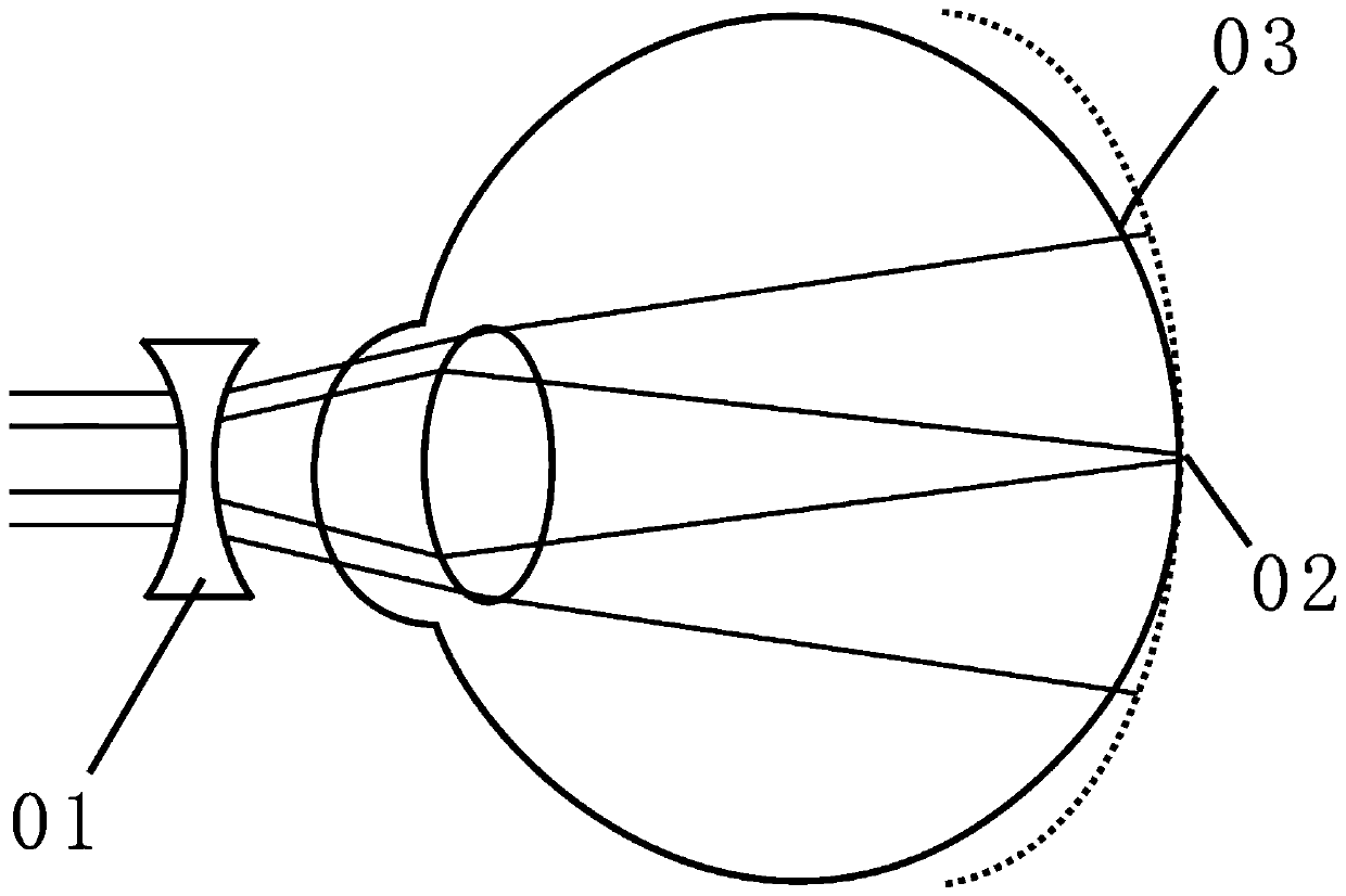 Spectacle lens capable of effectively relieving myopia deepening, corneal contact lens and lens pasting film