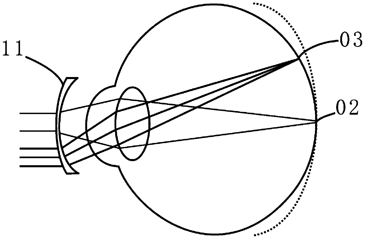 Spectacle lens capable of effectively relieving myopia deepening, corneal contact lens and lens pasting film