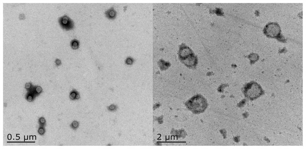 Method for detecting GST by combining magnetic single-drop microextraction fluorescent switch with PDAcoating vesicle