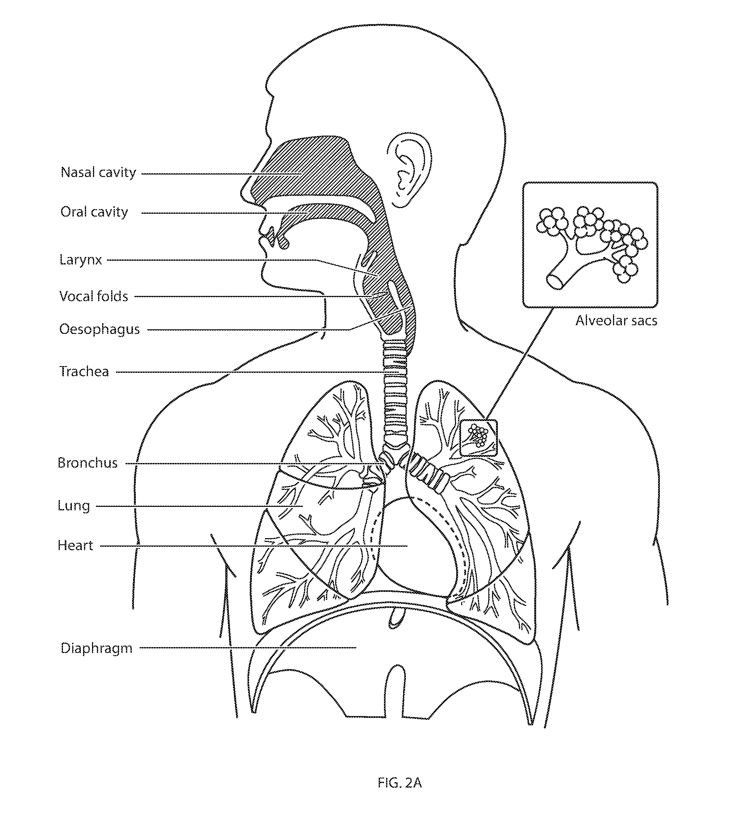 Respiratory therapy apparatus