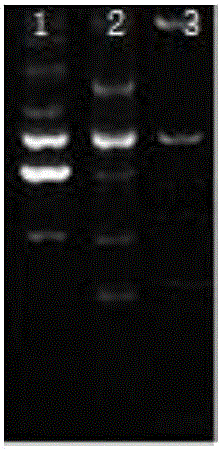 Diagnostic kit and detection method of sheep Xinjiang babesia U sp.