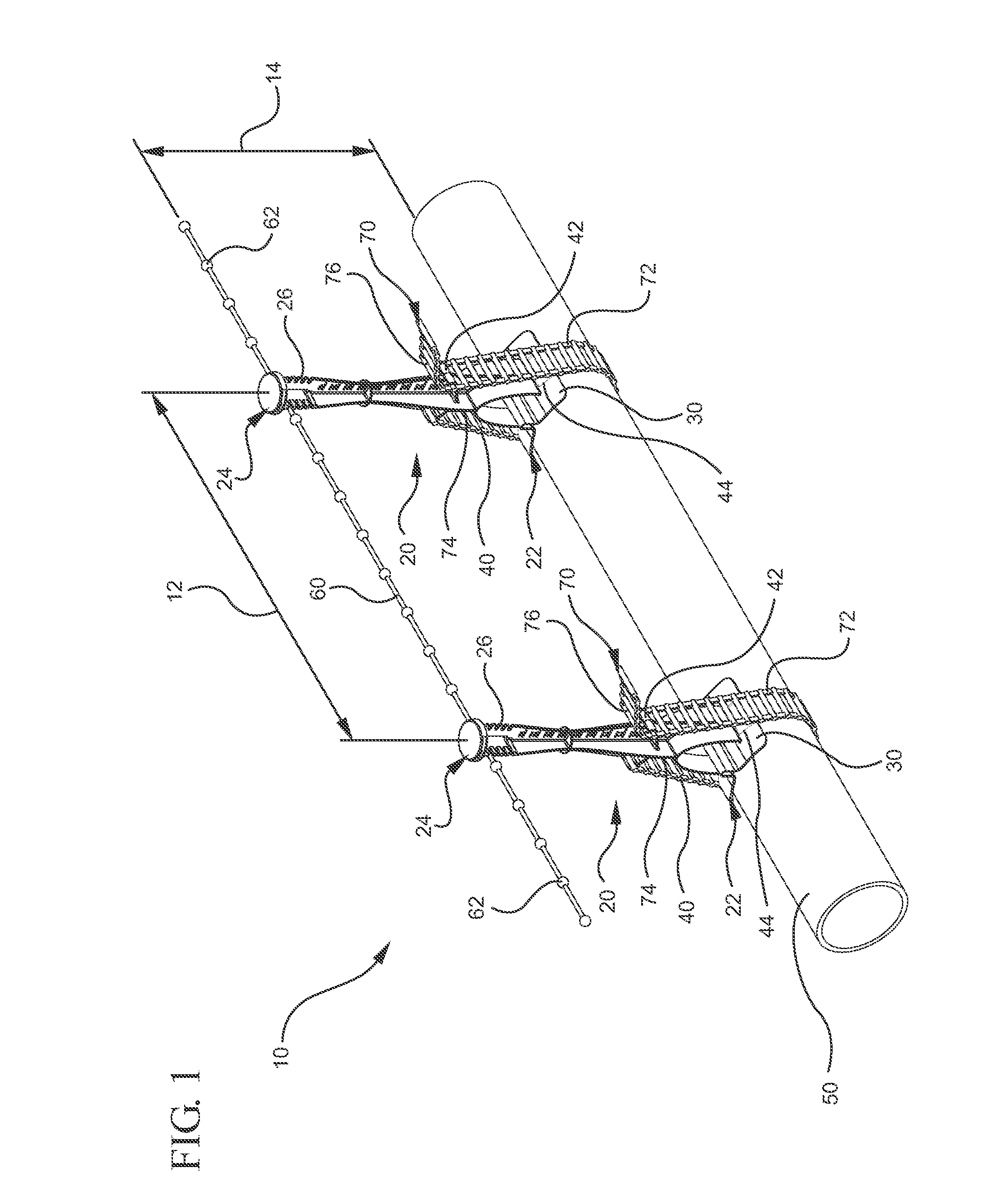 Systems and methods for marking and detecting an underground utility