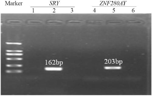 Detection method and application of bull ZNF280AY (zinc finger protein 280A, Y-linked) gene copy number variations (CNVs)