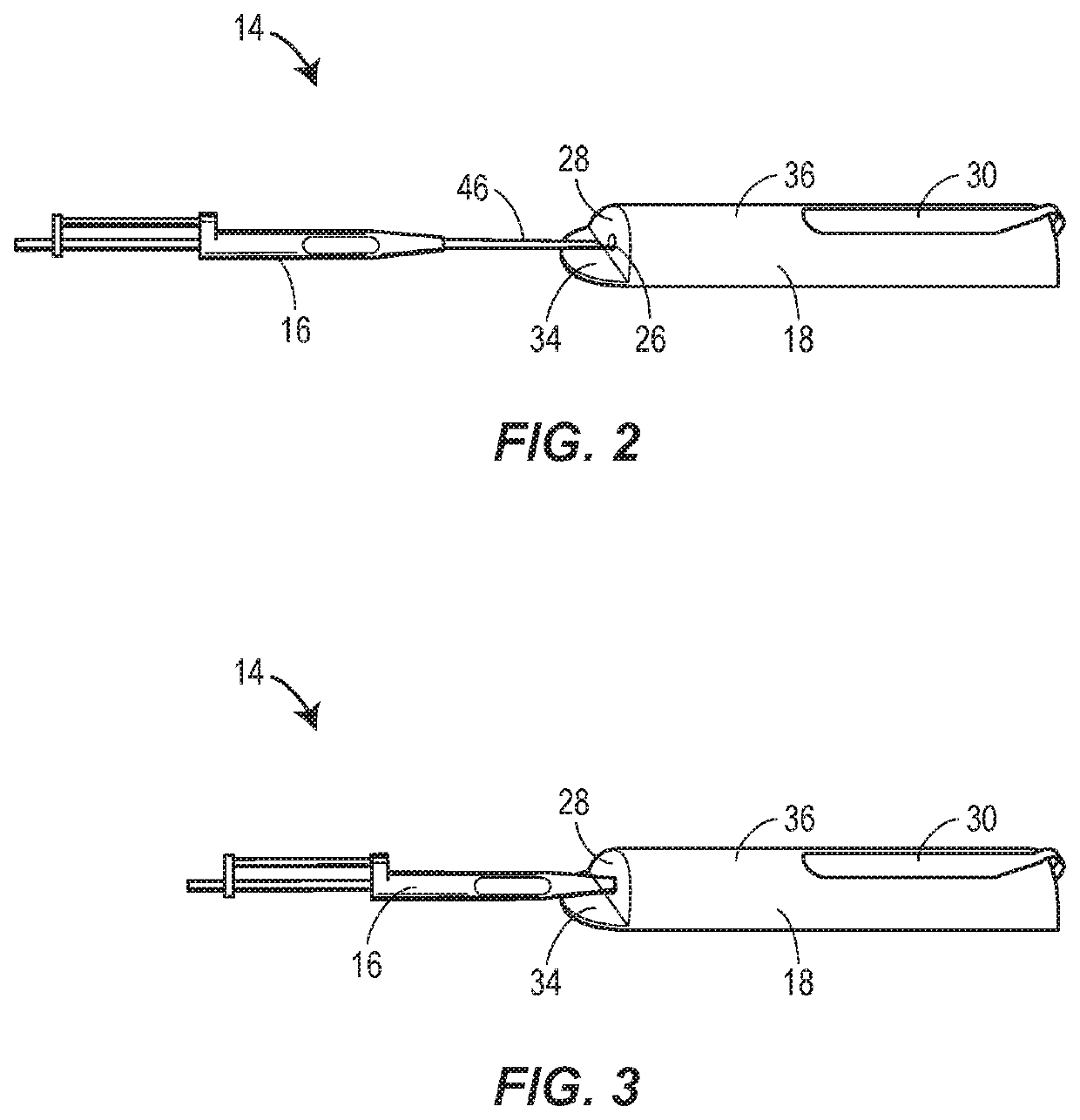Assistive device for subcutaneous injections or implants