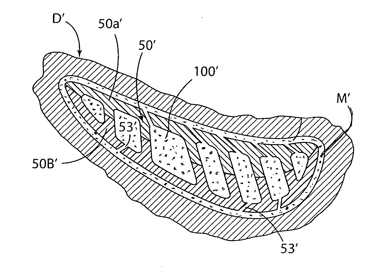 Cast-in cooling features especially for turbine airfoils