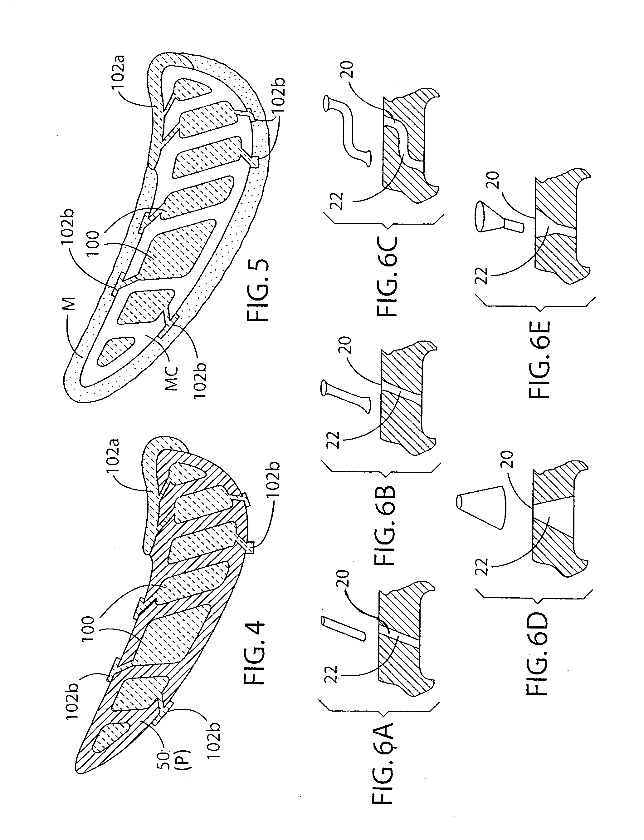 Cast-in cooling features especially for turbine airfoils