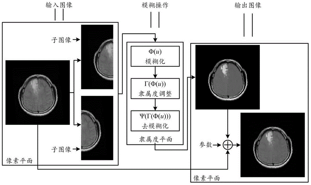 Image enhancement method based on intuitional fuzzy set