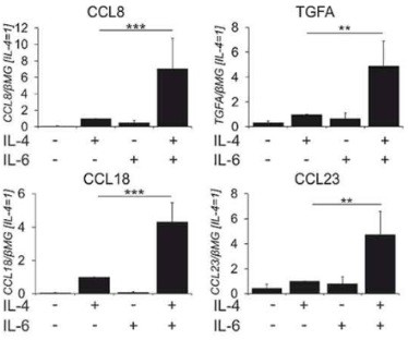 Application of IL-6R inhibitor and IL-4R inhibitor combined drug in breast cancer chemotherapy drugs