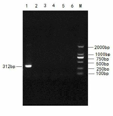 Porcine parvovirus nanometer alumina gel adjuvant inactivated vaccine and preparation method thereof