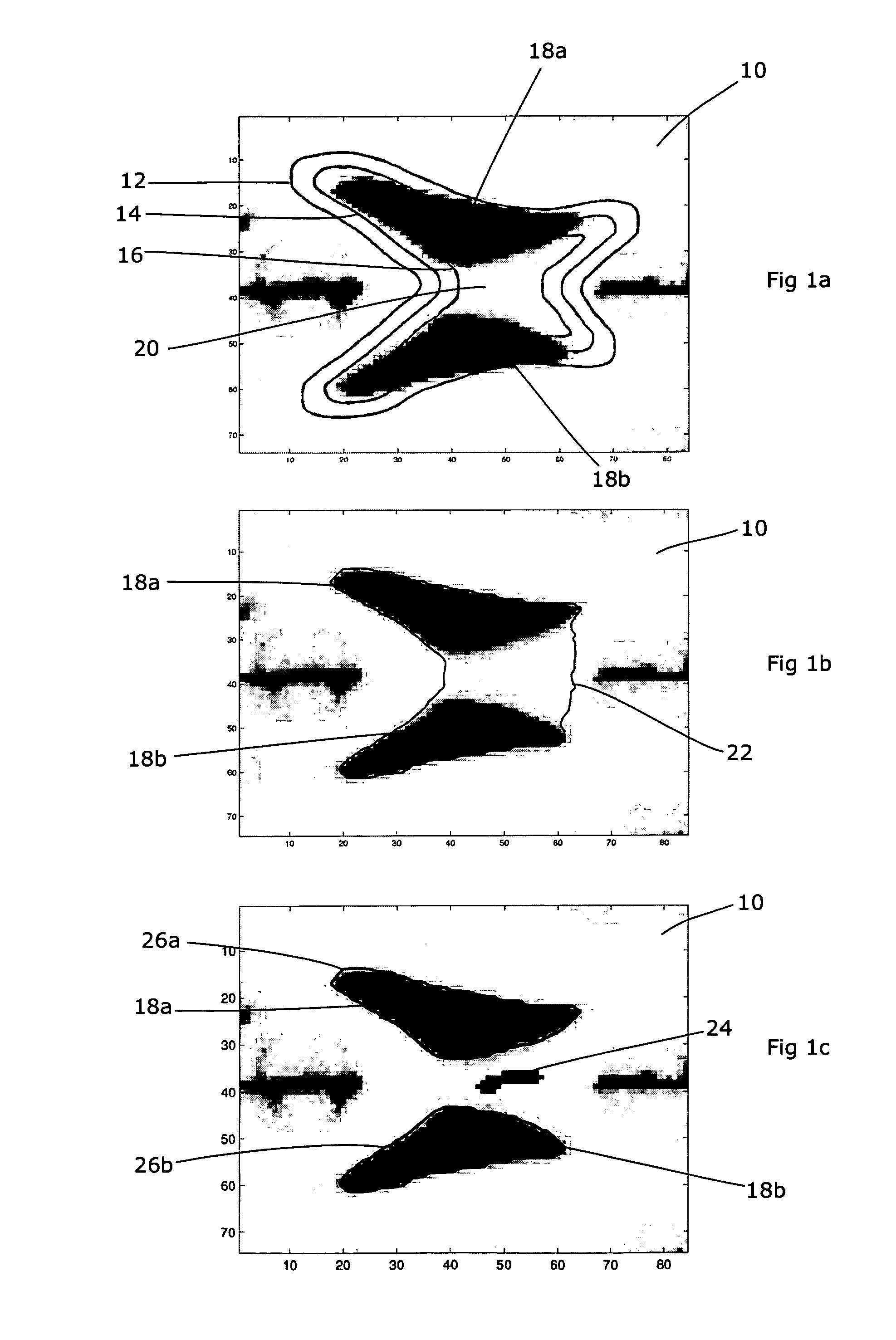 3D Medical Image Segmentation