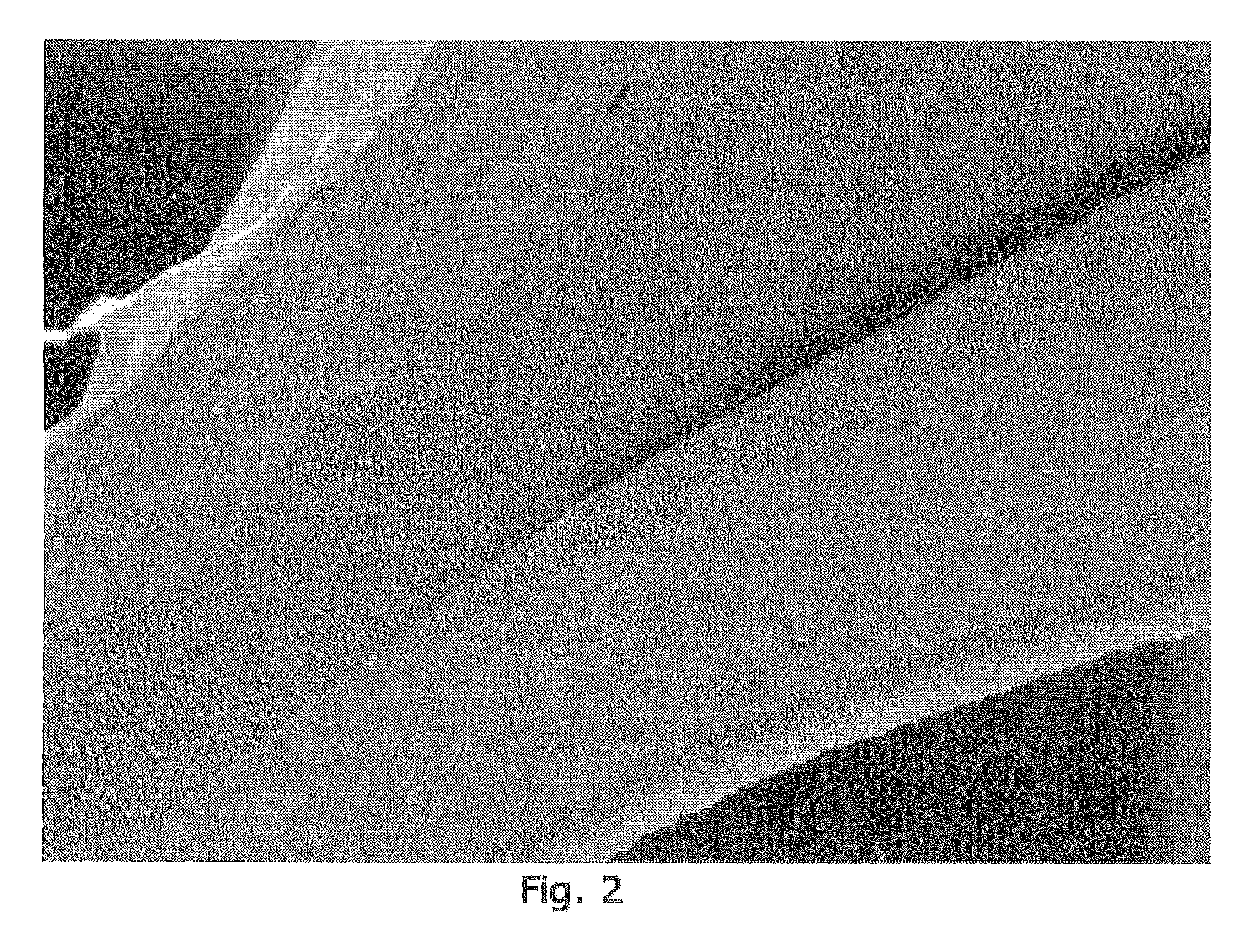 Method for the production of abrasive foams