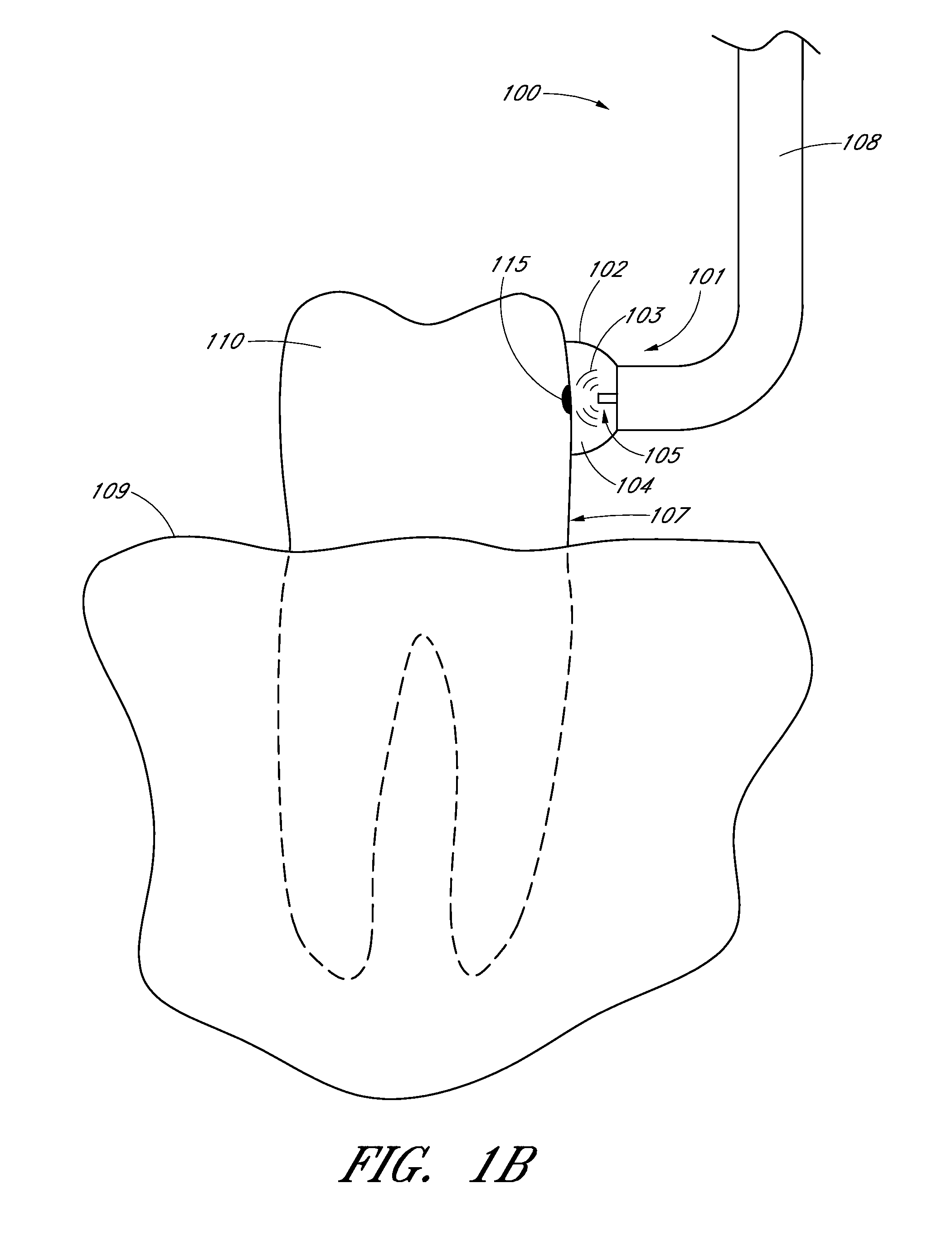 Apparatus and methods for cleaning teeth