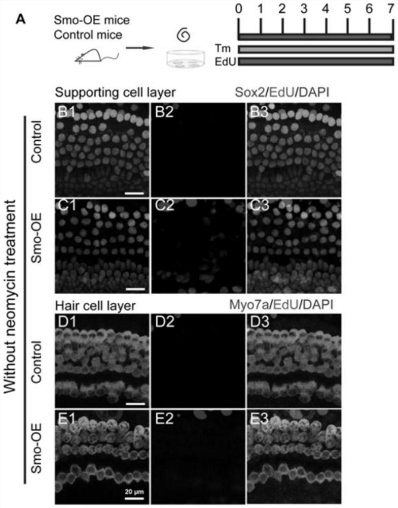 Method for regulating proliferation and differentiation of inner ear stem cells by using Rassf2 and application of Rassf2 in hair cell regeneration
