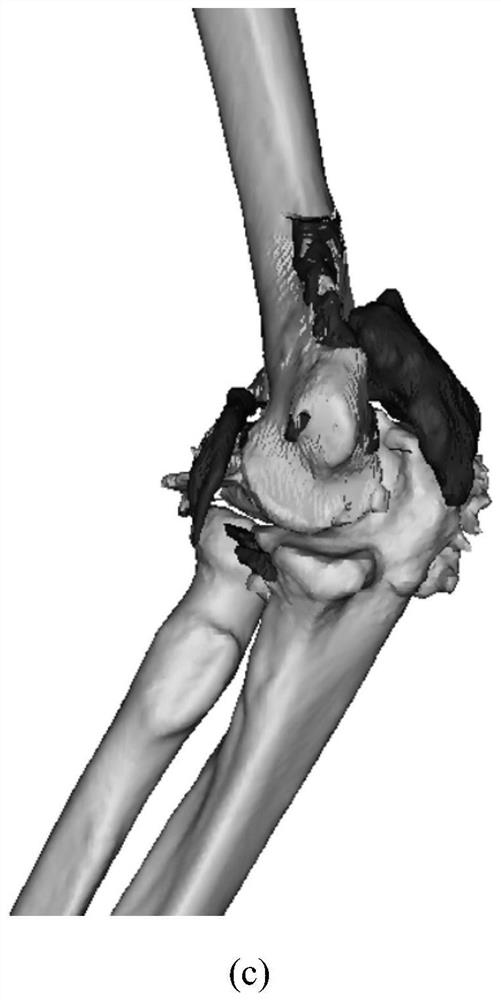 Heterotopic ossification CT image segmentation method and device, and heterotopic ossification CT image segmentation three-dimensional reconstruction method and device