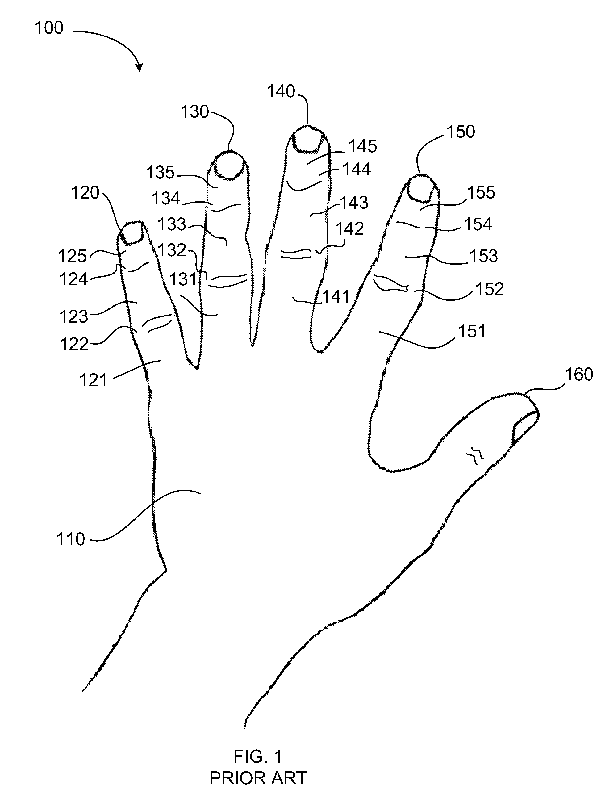 Medical device for an athlete's digits