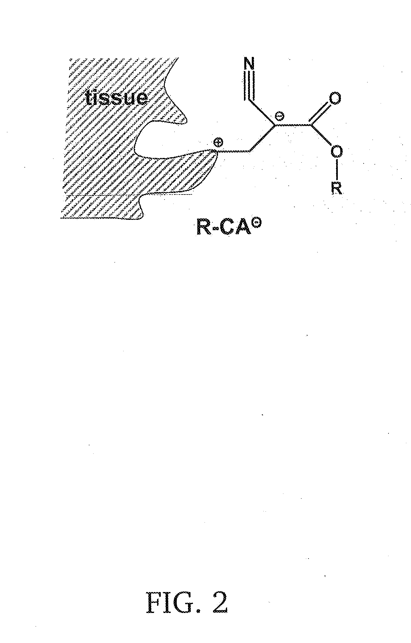 Poly(octylcyanoacrylate)-polyisobutylene polymer conetwork, method for the production thereof and uses thereof