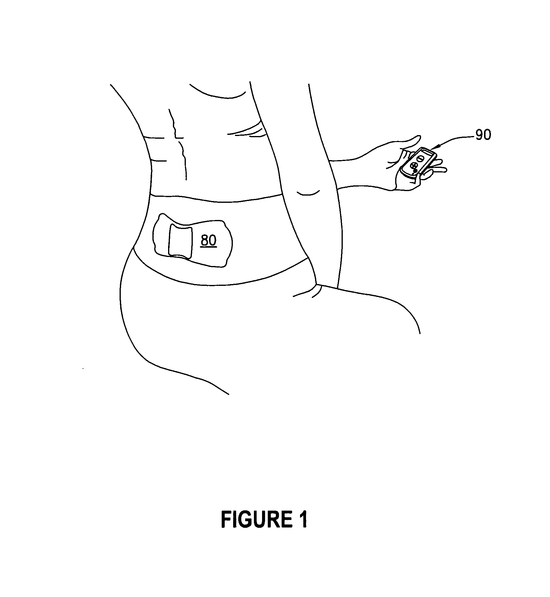 Portable TENS Apparatus And Method Of Use Thereof