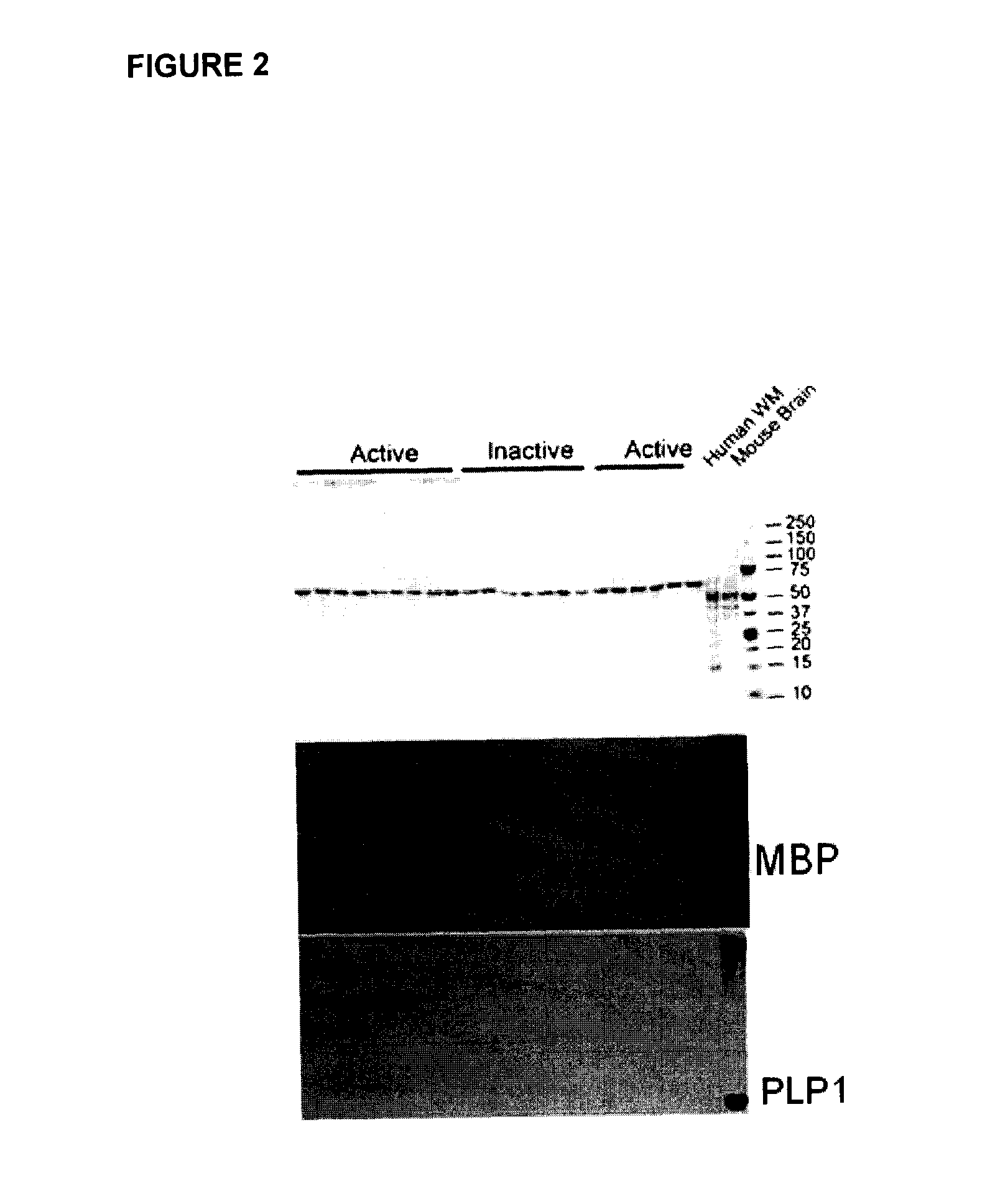 Biomarkers for multiple sclerosis