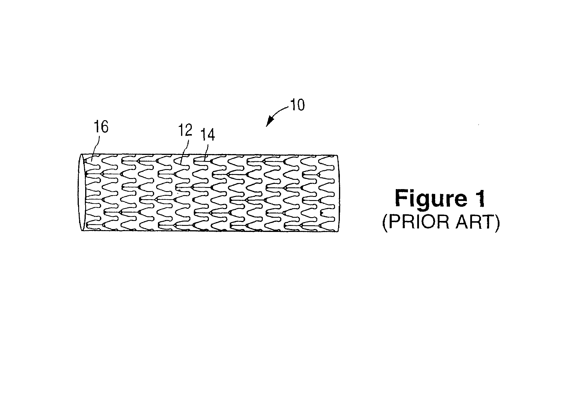 Support assembly for a stent
