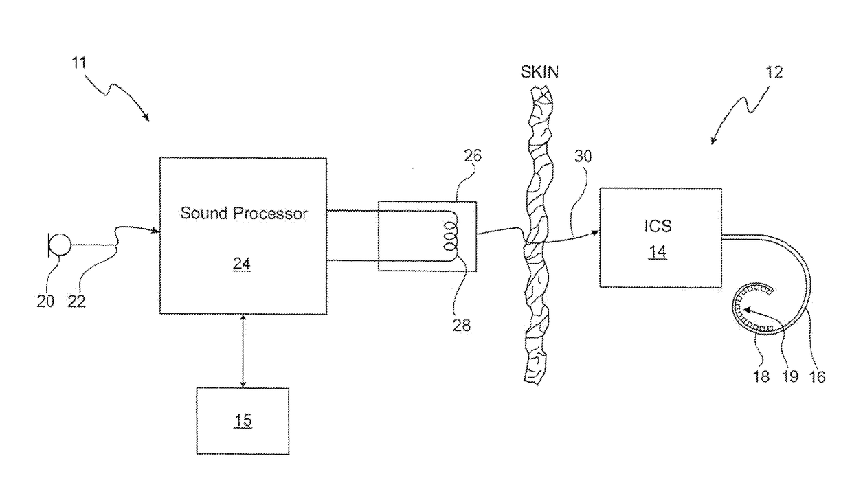 Bimodal hearing stimulation system and method of fitting the same