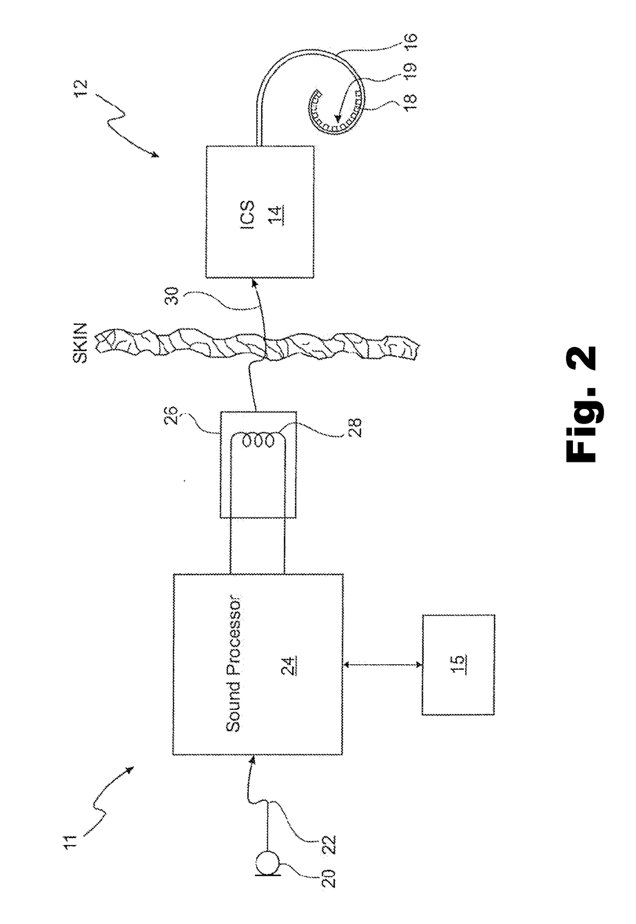 Bimodal hearing stimulation system and method of fitting the same
