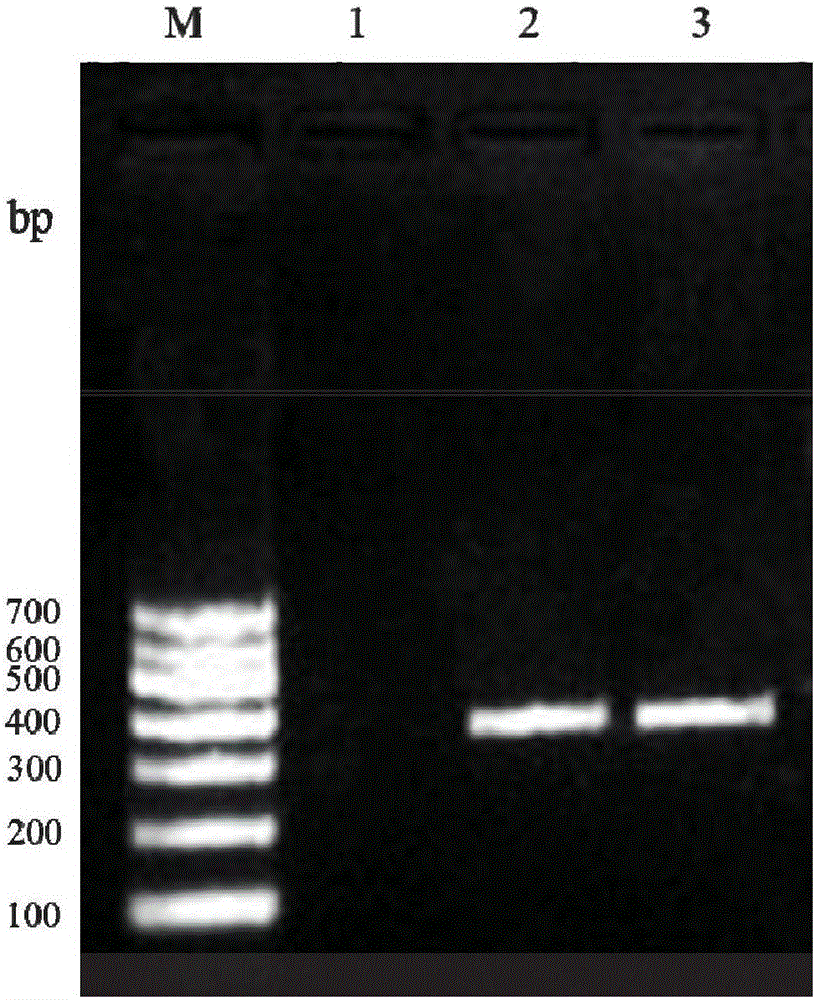 PCR detection kit and method for Klebsiella pneumonia infecting Chinese giant salamanders