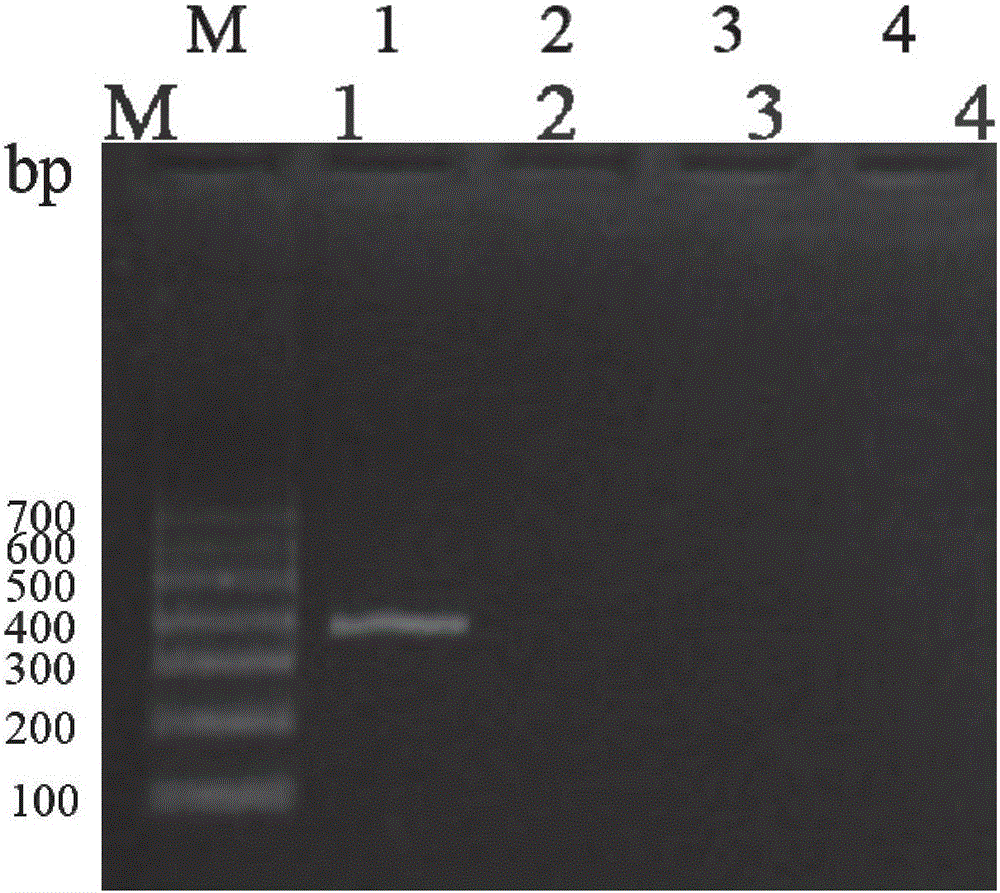 PCR detection kit and method for Klebsiella pneumonia infecting Chinese giant salamanders